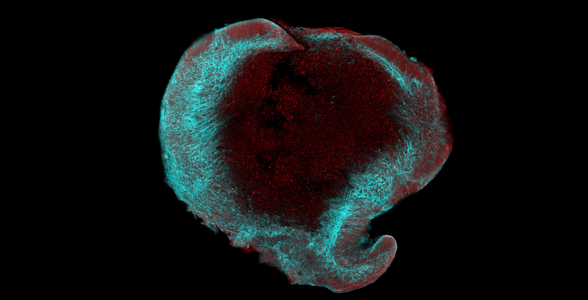 Toxická akumulace apolipoproteinu E jako nadějný cíl pro vývoj léků proti Alzheimerově chorobě